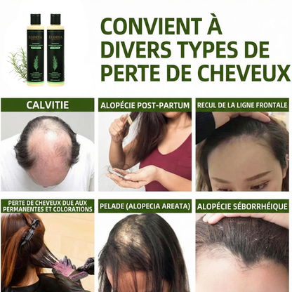 Organic Rosemary Hair Growth Shampoo