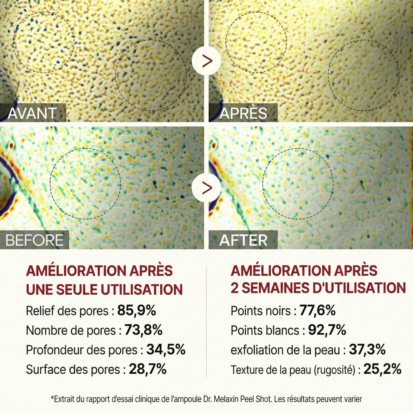 Elorya Rice Peel Serum Ampoule™