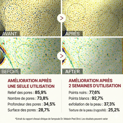 Elorya Rice Peel Serum Ampoule™